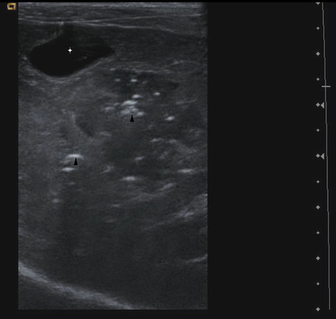Dating ultrasound medicare