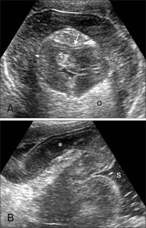 dog ultrasonography ultrasound / hund sonographie ultraschall