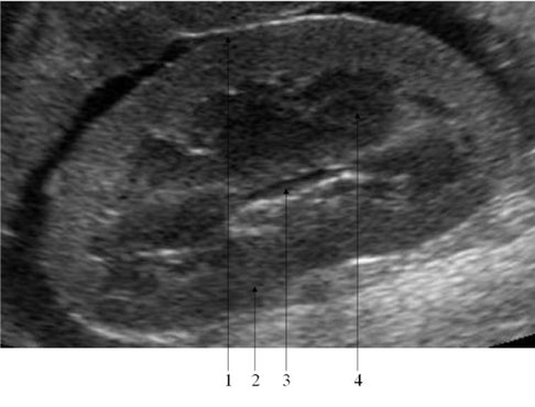 hund sonographie ultraschall / dog ultrasonography ultrasound