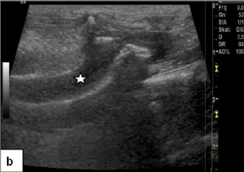 dog ultrasonography ultrasound / hund sonographie ultraschall