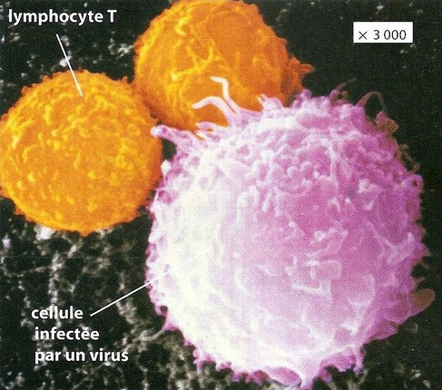 Deux lymphocytes T (en orange) s'accolant à une cellule de notre corps infectée par un virus (en rose). Source: http://jeanvilarsciences.free.fr/?page_id=673