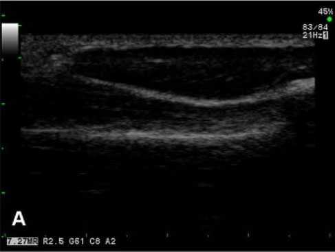 dog ultrasonography ultrasound / hund sonographie ultraschall