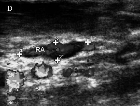 dog ultrasonography ultrasound / hund sonographie ultraschall