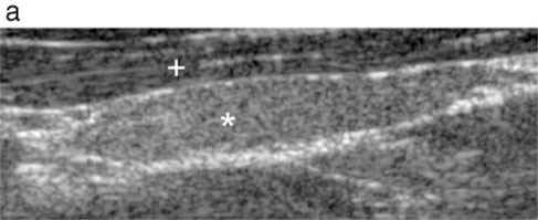 dog ultrasonography ultrasound / hund sonographie ultraschall