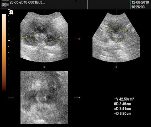 hund sonographie ultraschall / dog ultrasonography ultrasound