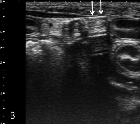 dog ultrasonography ultrasound / hund sonographie ultraschall