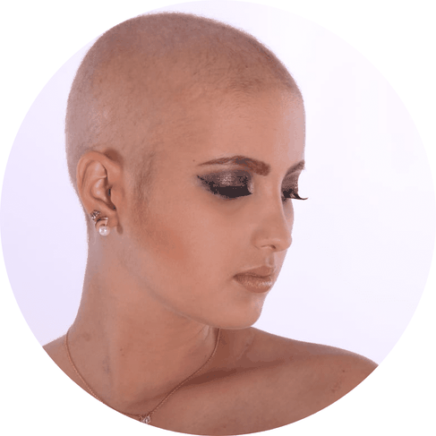 femme sans cheveux 