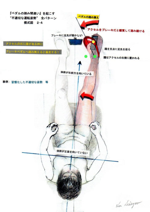 踏み間違いが起きる姿勢・動作
