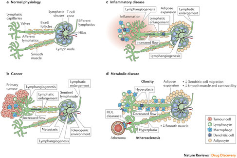 Ein Lymphknoten mit Lymphgefäßen in unterschiedlichen Zuständen.