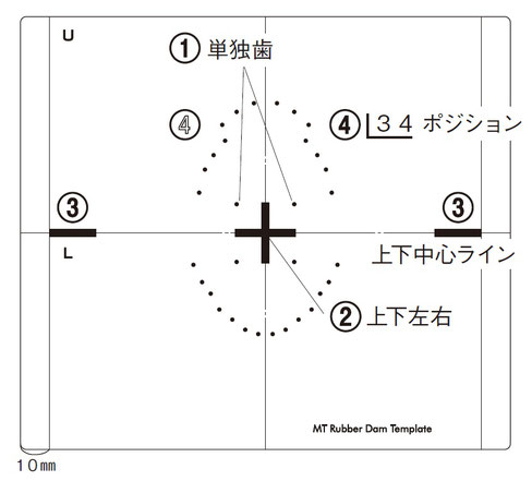 MT かんたん ラバーダム テンプレート