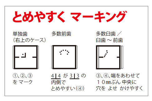 MT かんたん ラバーダム テンプレート