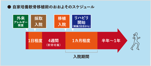 自家培養軟骨移植　治療スケジュール　どのくらいかかる？　リハビリ　入院期間