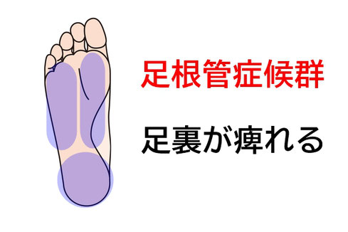 足底 足裏 の痛み 公式 鍼灸院 鶴 札幌市東区