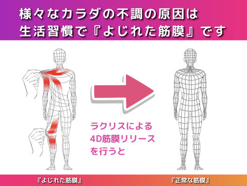 大阪　寝屋川　香里園　筋膜リリース　整体　マッサージ　肩こり　腰痛　頭痛