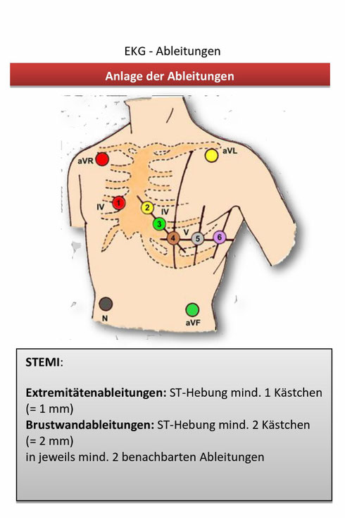 EKG-Merkkarte als Download: - RD-Portal MI-LK