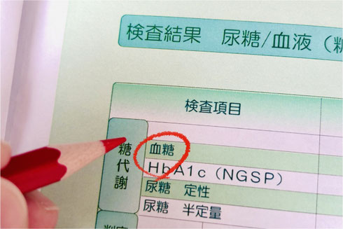 Hba1c