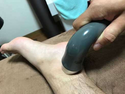 小牧 捻挫 急性外傷 鍼灸 超音波