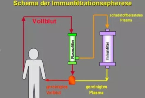 德国欧亚商旅 Orasien GmbH INUS血液排毒净化疗法