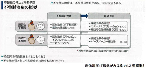 不整脈治療の概要