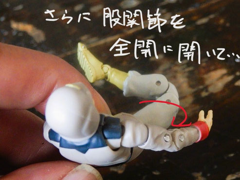 O脚の悩み