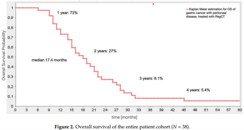 Kaplan-Meier-Kurve zur Überlebensdauer von Patienten mit Peritonealkarzinose bei Magenkrebs, behandelt mit regionaler Chemotherapie; medianes Überleben 17,4 Monate, 1-Jahres-Überlebensrate 73 %.