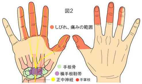 ない 握れ が 手 痛い