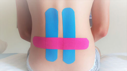 Kinesiotaping Basel, Taping in Basel in der Physiotherapie Santewell