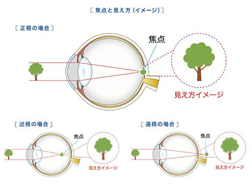 小児の弱視と視機能発達 小児の弱視と視機能発達 | 三木 淳司, 荒木 俊介 |本 | 通販