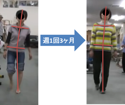 歩行姿勢　身体の傾き軽減　左脚伸びる　歩行速度向上