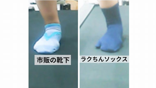 靴下着用により足部内側アーチの膨満が強まり、支持軸が内側化。これが足裏の凸部形成（マメ・胼胝）の主要因となる。