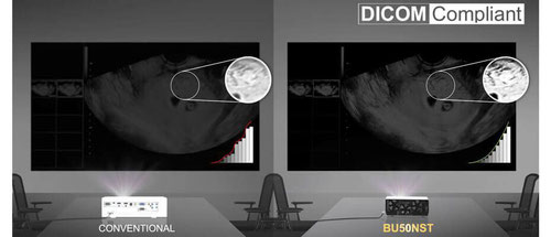 LG BU50NST erfüllt auch den DICOM Standard  - beamer-freund