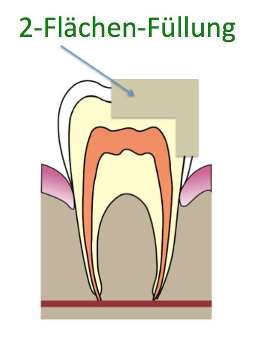 Alle Zahnfüllungen im Überblick Interview mit Dr. Peter Klein, BA Bambus Zahnbürsten & Bio