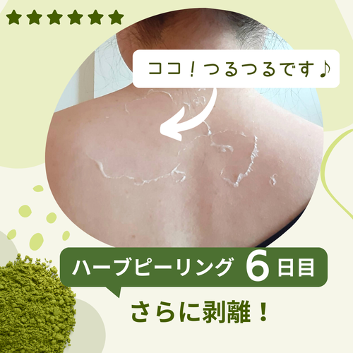 12月31日まで！【年末大特価セール】剥離ありハーブピーリング20回分 12月31日まで【大特価年末セール】剥離ありハーブピーリング20回分