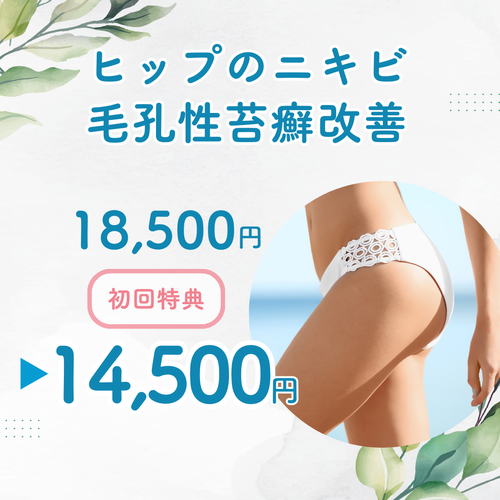 札幌エステ ヒップのニキビ・ニキビ跡・毛孔性苔癬改善/スピキュール(針状成分)配合ハーブピーリング