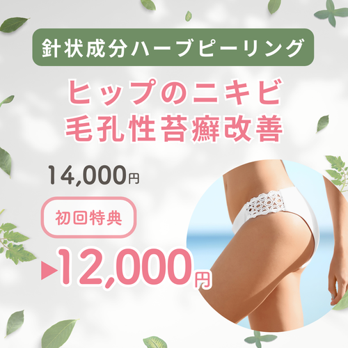 札幌エステ ヒップのニキビ・ニキビ跡・毛孔性苔癬改善/スピキュール(針状成分)配合ハーブピーリング
