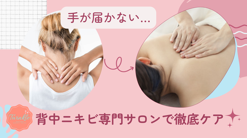 セルフケアが難しい背中は背中ニキビ専門サロンで徹底ケア