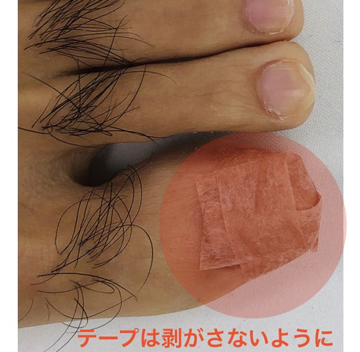 ワイヤーの保護方法