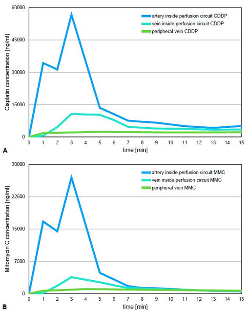 Grafiken zur Konzentration von Cisplatin und Mitomycin in arteriellen, venösen und peripheren Blutproben während einer Perfusion, mit Fokus auf lokalisierte Tumortoxizität und reduzierter systemischer Belastung durch Chemofiltration.