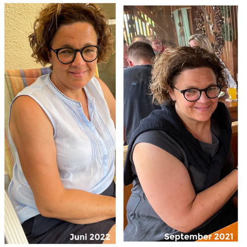 Lipödem Erfahrungen von Patientinnen CG Lympha