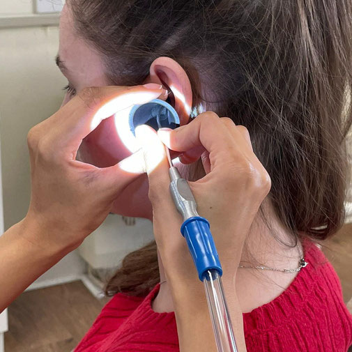 Closeup of a girl in a red sweater having microsuction performed on her using perfect bracing technique