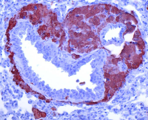 A granuloma stained with Mac-2 in a Tsc2Lyz2 mouse. 