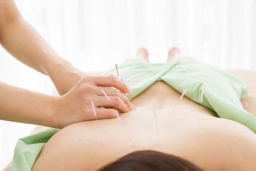 Akupunktur bei PMS, Praxis für Frauenheilkunde und TCM, Sarah Diez
