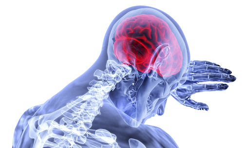 Mensch im Röntgenbild mit CMD craniomandibulärer Dysfunktion, Kieferschmerzen und Nacken schmerzen 