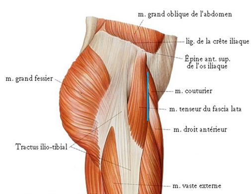 cadera protesis vía anterior, Dr Rémi Toulouse cirugía ortopedia La Croix du Sud