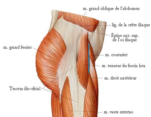 total hip replacement of osteoarthritis Dr Rémi Toulouse France Clinic Capio Croix du Sud