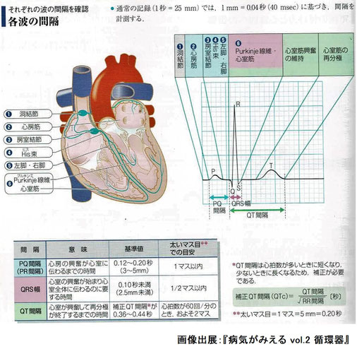 心臓の解剖と各波の間隔