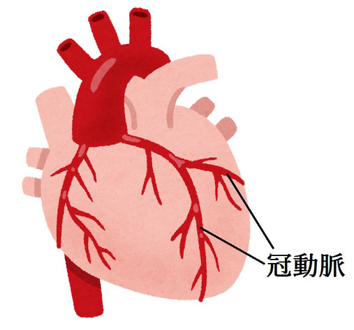 川崎病,心臓,動脈