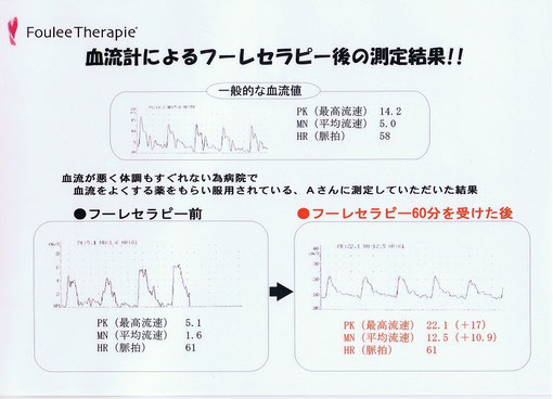 血流量の変化