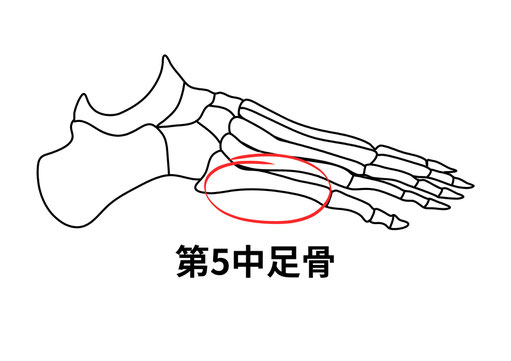 第5中足骨の位置
