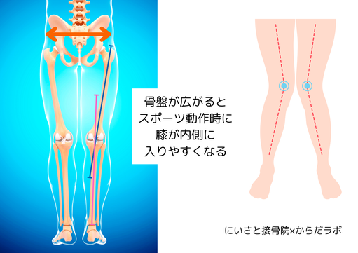 骨盤が広がるとスポーツ動作時に膝が内側に入りやすくなる